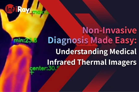 非侵襲的診断が容易になりました: 医療用赤外線赤外線画像を理解する